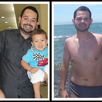 Antes e Depois Fabio